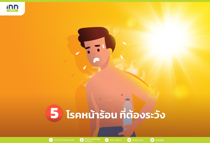 5 โรคหน้าร้อน