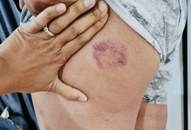 แท็กซี่ตระเวนใช้หนังสติ๊กยิงร้านอาหาร