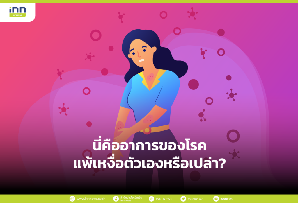 อาการของโรคแพ้เหงื่อตัวเอง