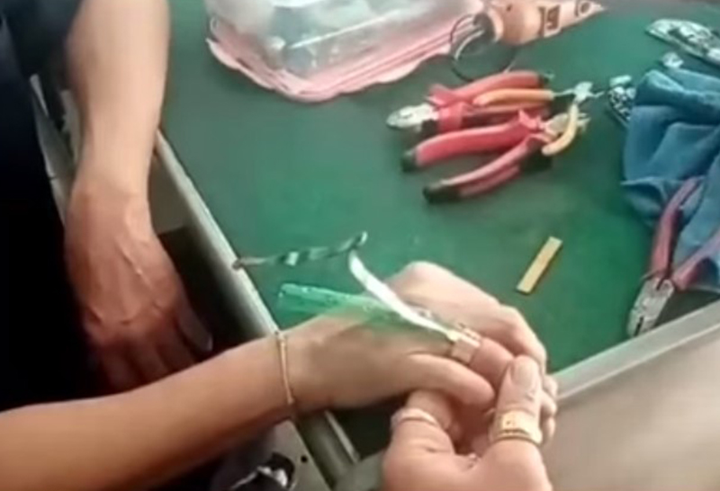 แหวนติด จนนิ้วมือบวม ถอดไม่ออก ... อาสาร่วมด้วยช่วยคุณได้!