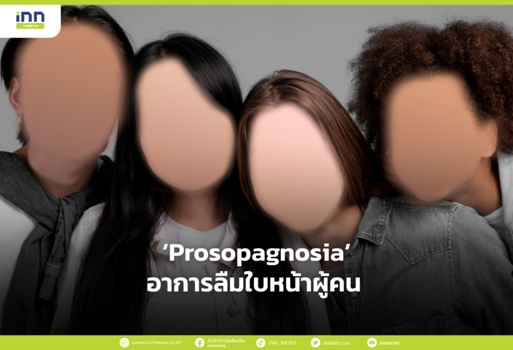 Prosopagnosia อาการลืมใบหน้าผู้คน