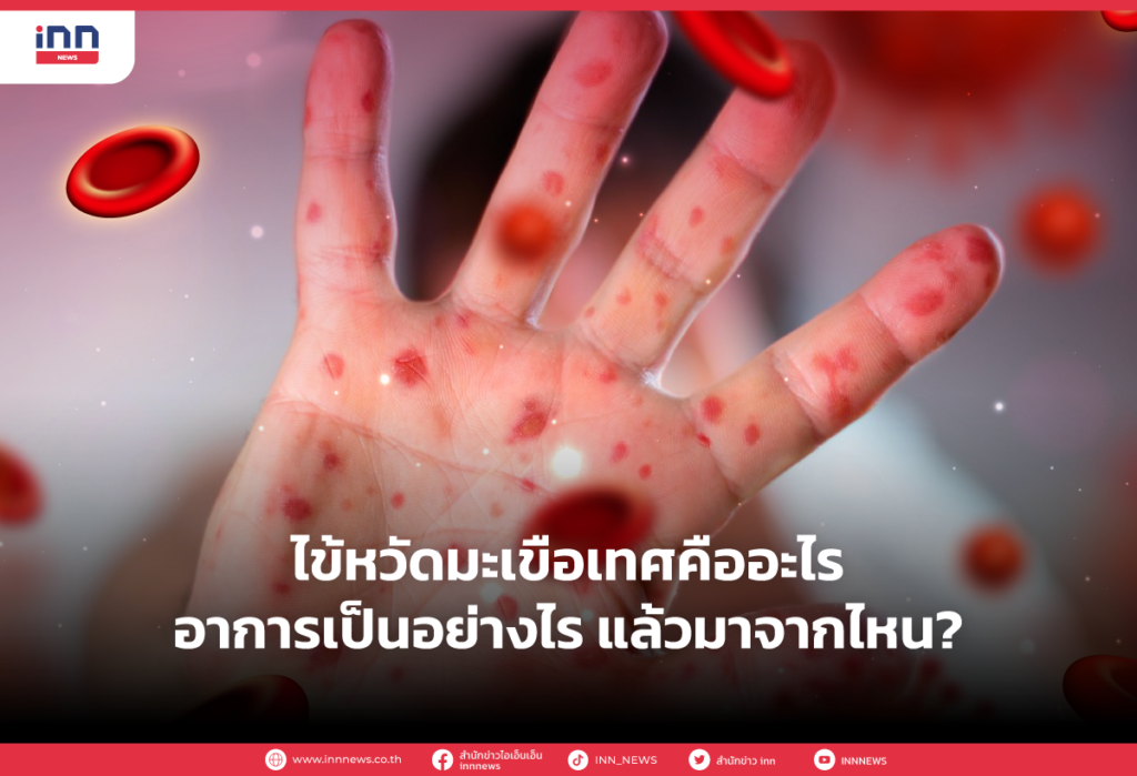 ไข้หวัดมะเขือเทศคืออะไร