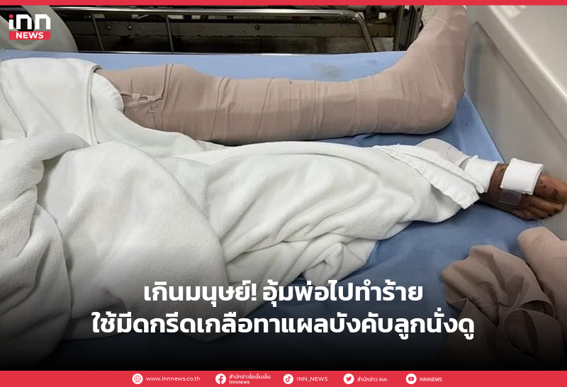 ทำร้าย