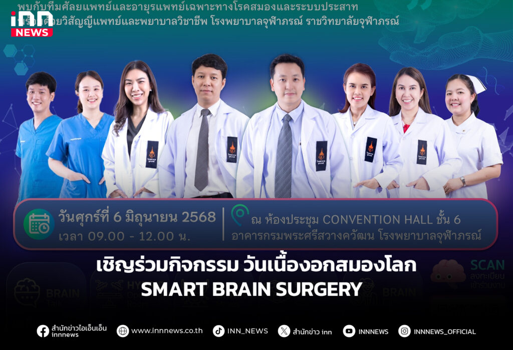 เชิญร่วมกิจกรรมวันเนื้องอกสมองโลก SMART BRAIN SURGERY 