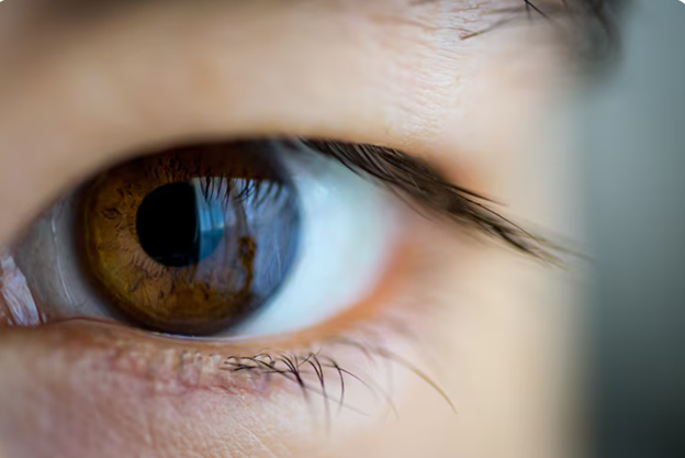 4 ข้อดีของการผ่าตัดกล้ามเนื้อตาอ่อนแรง